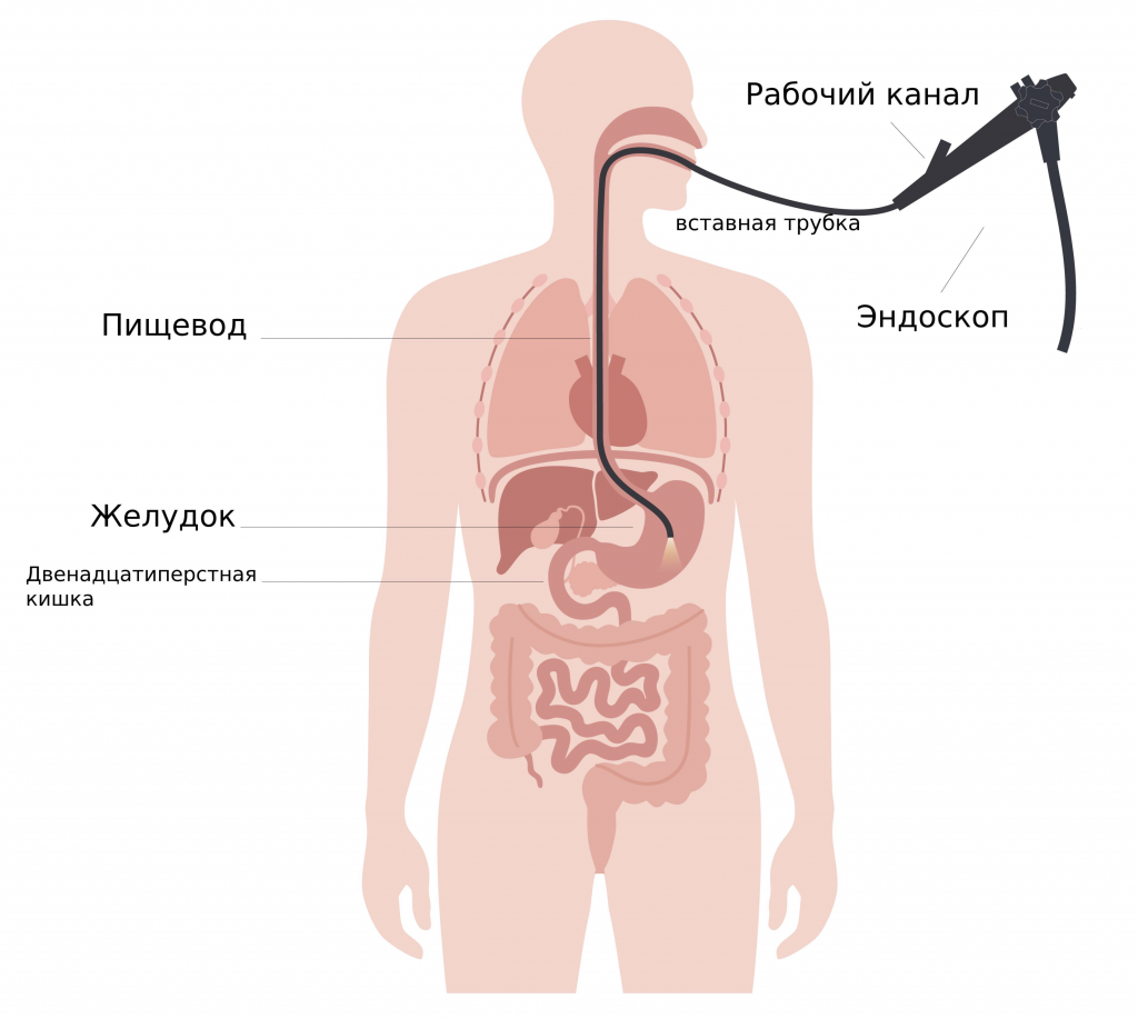 ФГС-fotor-2025052613423.png ФГС-fotor-2025052613423.png