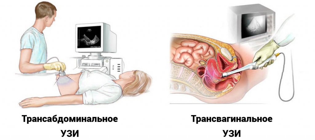 узи омт трансваг и трансабд-fotor-20250527165431.png узи омт трансваг и трансабд-fotor-20250527165431.png