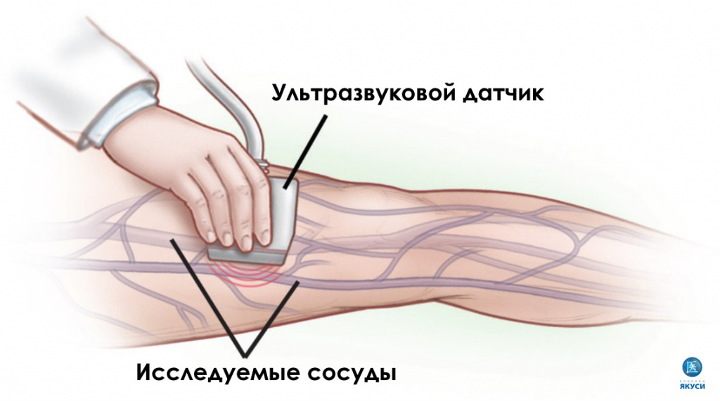 УЗИ сосудов вен нижних конечностей.jpg УЗИ сосудов вен нижних конечностей.jpg