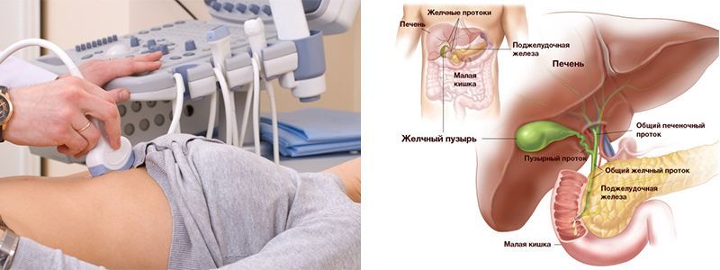 УЗИ печени и желсного пузыря.jpg УЗИ печени и желсного пузыря.jpg