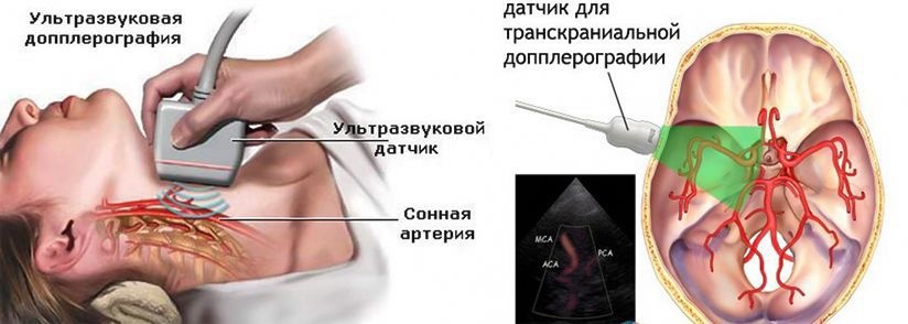 ДУпплексное сканирование головы и шеи.jpg ДУпплексное сканирование головы и шеи.jpg
