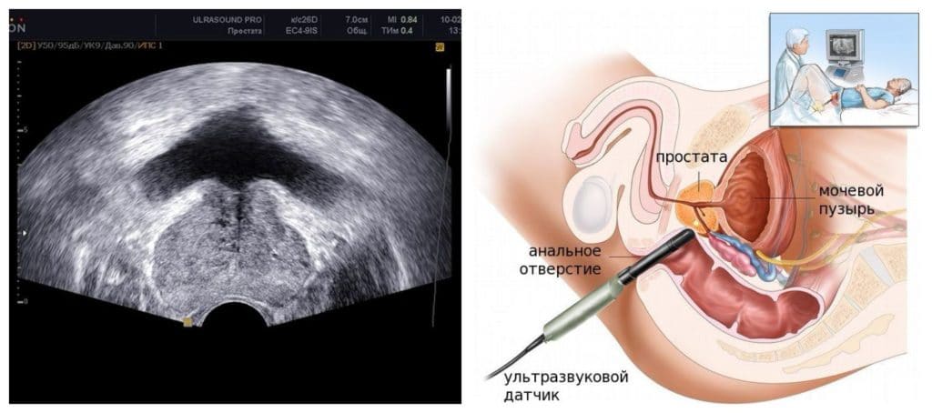 ТРУЗИ.jpg ТРУЗИ.jpg