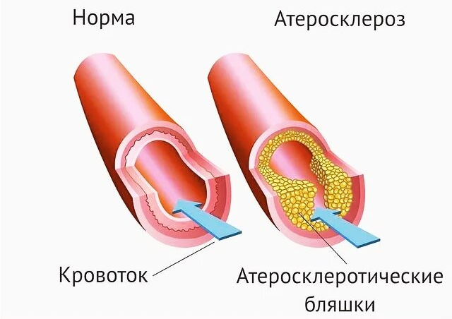 Липидный профиль-fotor-2025053015128.png Липидный профиль-fotor-2025053015128.png