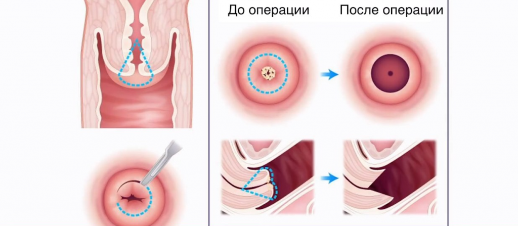 ножевая биопсия-fotor-2025052395150.png ножевая биопсия-fotor-2025052395150.png